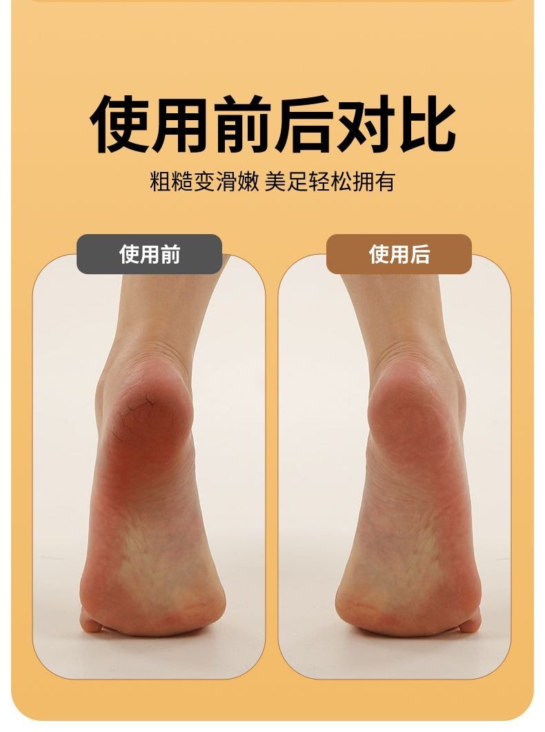 Kanju Xiaomi Style Electric Foot File for Pedicure, Fully Automatic Top-Model with LCD, 3 Grinding Heads