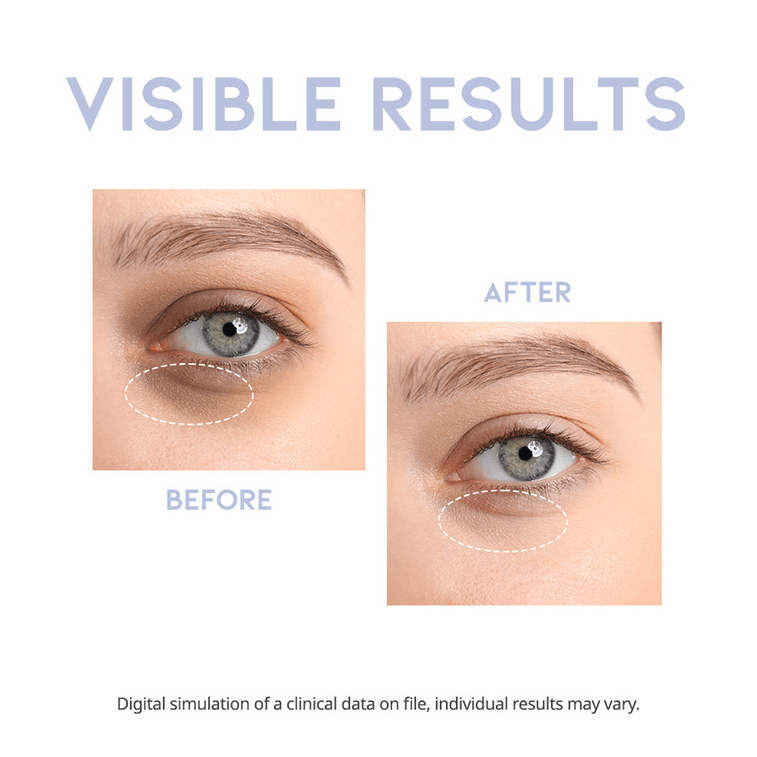 Intensive Eye Serum, 0.85 fl oz + Overnight Eye Cream, Vitamin C, Collagen, 1 fl oz【H+ Day, P+ Night】 9