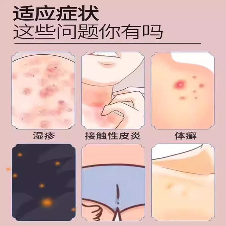 白云山 曲咪新乳膏10g皮康霜 皮炎湿疹膏神经性皮炎止痒 手足癣体癣股癣痒痒膏 皮肤外用药膏 3