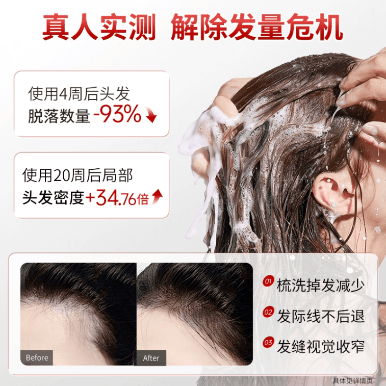 Anti-Hair Loss Shampoo, 500g * 1 Bottle 3