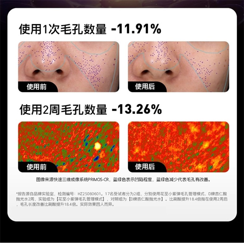 【品牌国内同价】FLOSSOM花至 小紫弹智能射频美容仪器 家用智能美容仪 多功能分区护理 脸部&颈部提拉紧致 速渗透 强透亮FR200 1 件