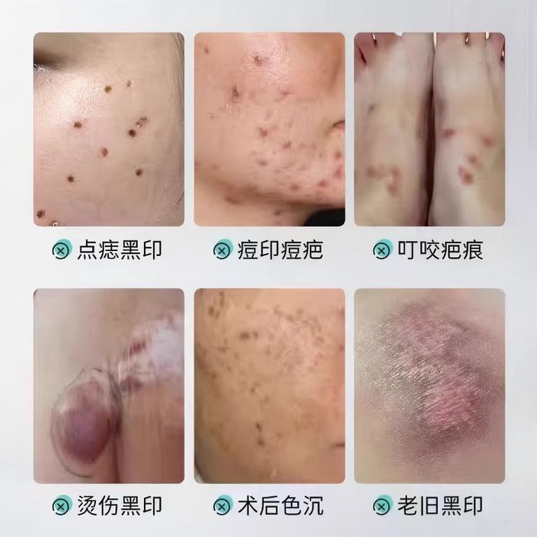 Recombinant Type III Humanized Collagen Dressing 20g Skin care recovery 6
