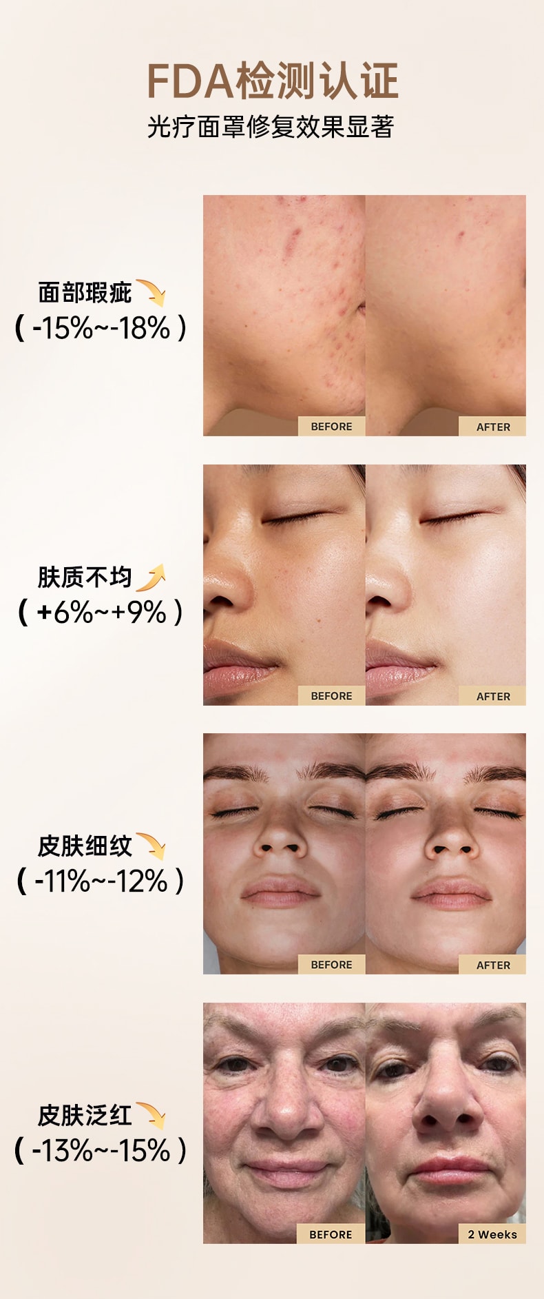 依恋 【达人种草 热销爆品】LED光疗面罩 多光谱红外光联合护理 黑色 1件