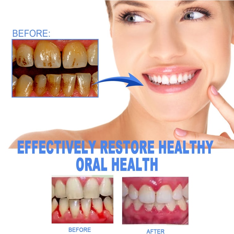 Tooth Repair Gel Repairs Gum Swelling And Pain Deep Cleans Tooth Stains And Plaque Oral Care Gel 4ML 8