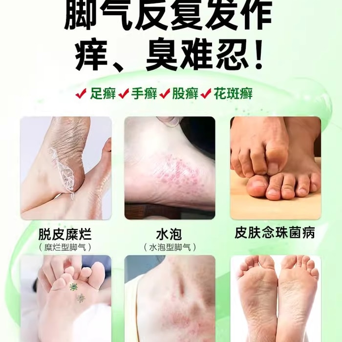【中国直邮】 鲁南 搽剂 脚气止痒脱皮杀菌脚臭脚痒真菌感染专用药 10mL x 1盒 4