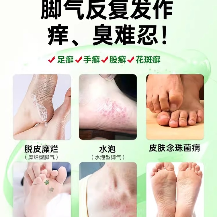 【中国直送】ルナンクリーム - 水虫治療薬 かゆみ・皮むけを鎮め、殺菌、足の臭いやかゆみを軽減、真菌感染症の特効薬 10g×1箱 3