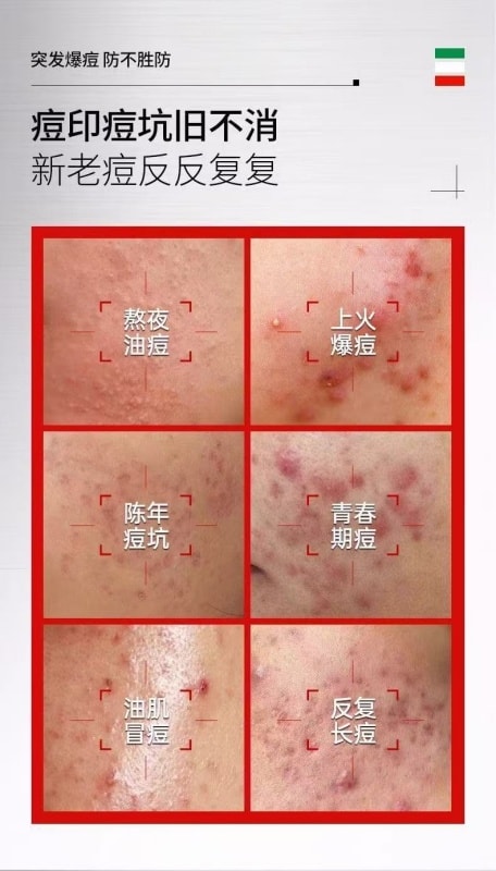 广药白云山 [直邮] 白云山 壬二酸清痘祛痘膏15g