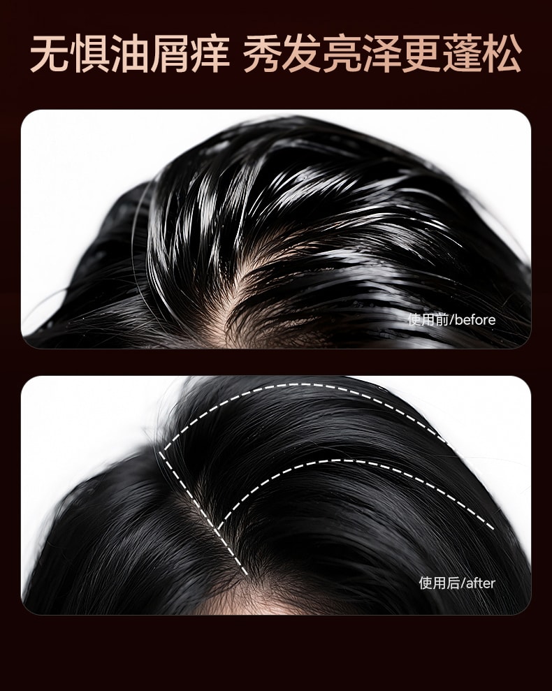 【中国直邮】 和草集 去屑控油洗发水 蓬松止痒改善头皮清爽不油腻 300ml/瓶