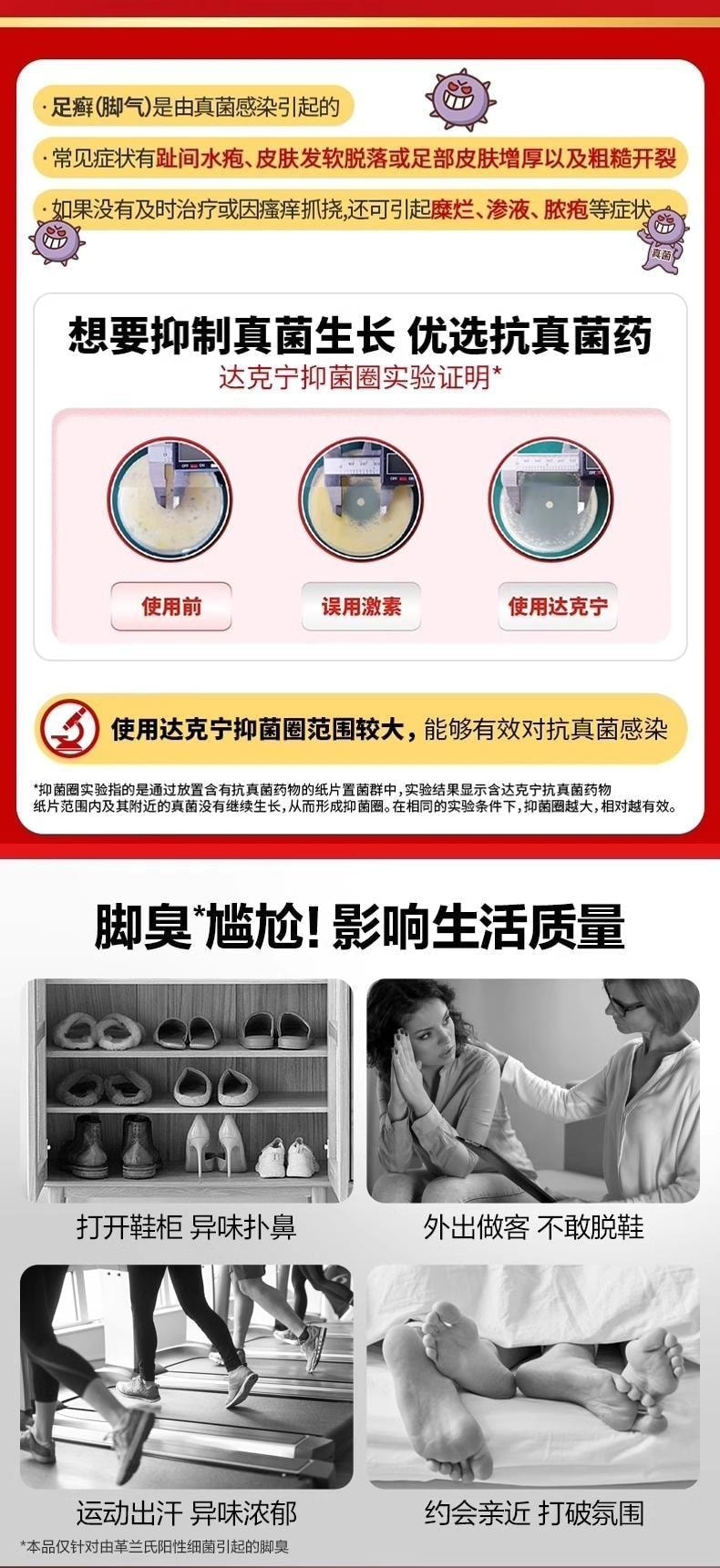 【中国直邮】 达克宁 盐酸特比萘芬喷雾剂 30ml 脚气喷雾 手癣 足癣 体癣 股癣 花斑癣