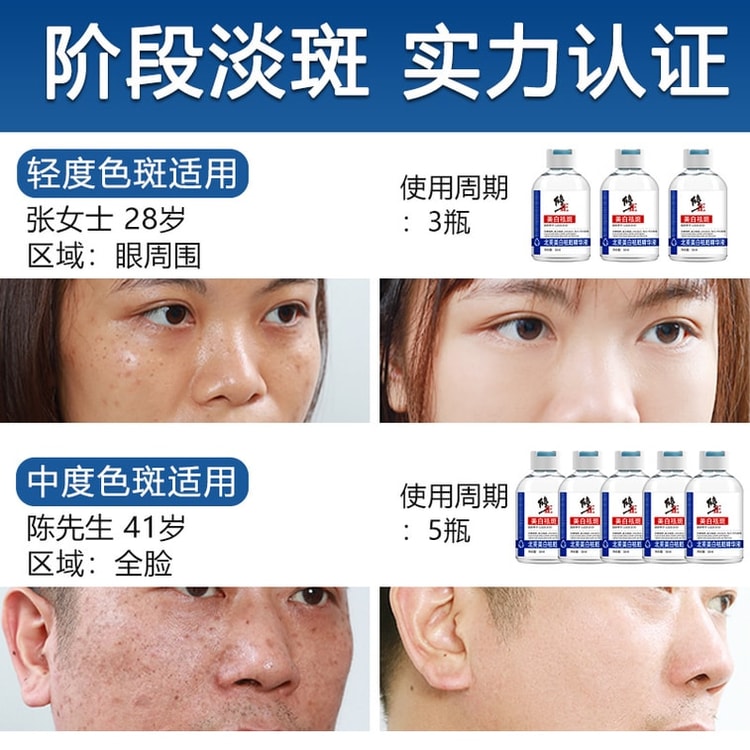 XIUZHENG 中国 美白補正シミ取り 3日間美白でシミを軽く 50ml/本（小紅