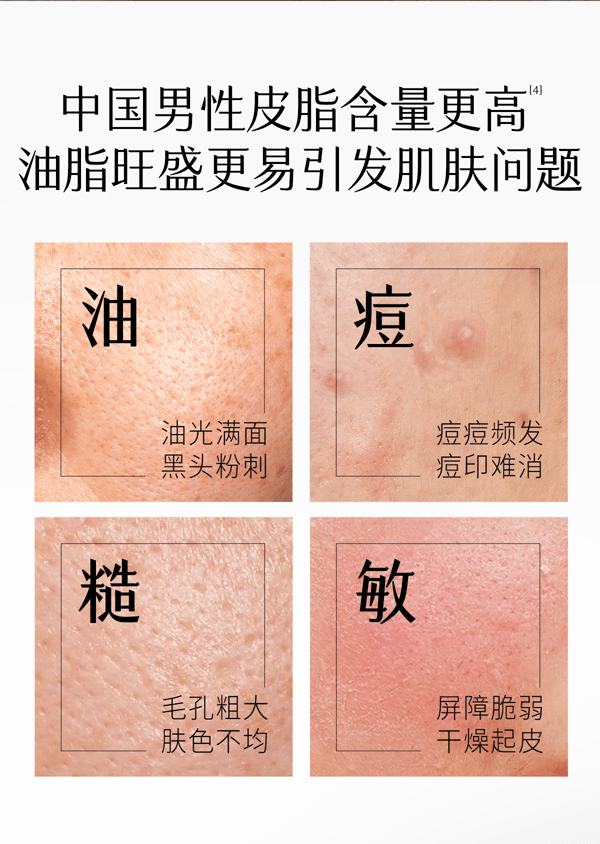 穀雨 男士乳液 補水保濕控油【國人男士專研】 【痘印-20.01%】 春夏季修護 潤膚乳 60ml