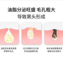 VSEA 去黑头鼻 鼻贴【黑头自动浮出 毛孔清洁】袪粉刺 温和清爽 去黑头 去粉刺 不刺激鼻膜5片10袋