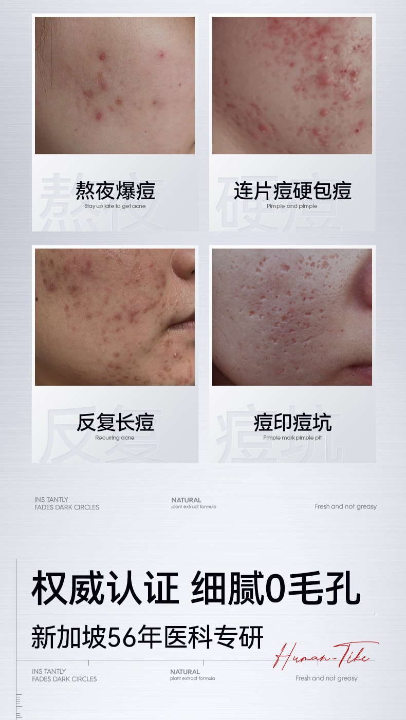 【中国直邮】 新加坡 Kuvive 水杨酸细腻毛孔精华 收缩毛孔精华液 修复粗大面部收敛祛痘印去闭口粉刺敏肌 50ml/瓶