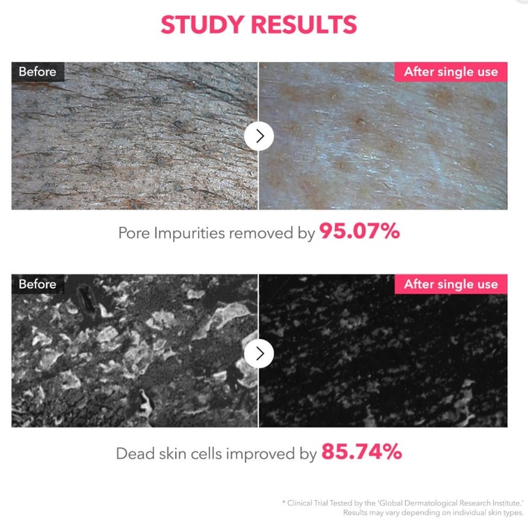 【美国直邮】韩国 aprilskin April Skin 烟酰胺深层洁面乳120克 5