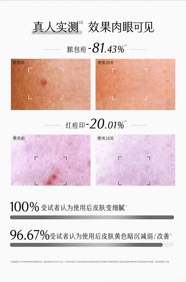 穀雨 男士套裝-水乳潔面素顏霜 控油祛痘【淘寶TOP 1熱銷榜男士護膚套裝】【性價比夯爆】【國人男士專研】節日/生日禮物 (洗面乳120g+爽膚水120ml+乳液80ml+素顏霜50g+男士禮盒)