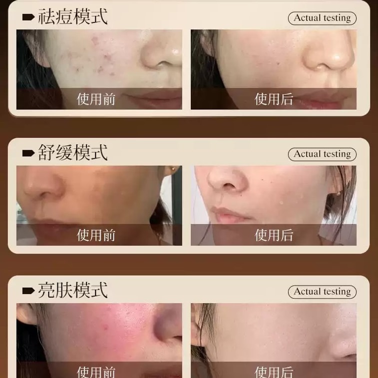 【中国直邮】 康佳 红蓝照光面罩 美容仪脸部家用大排灯院线专用光谱面膜光子嫩肤 尊金墨 1件