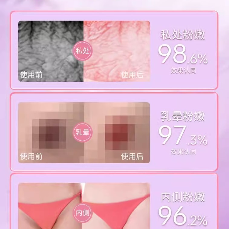 Shunami デリケートゾーン用美白クリーム、色素沈着除去、乳輪、内股、乳首をピンクにケア 50ml 3