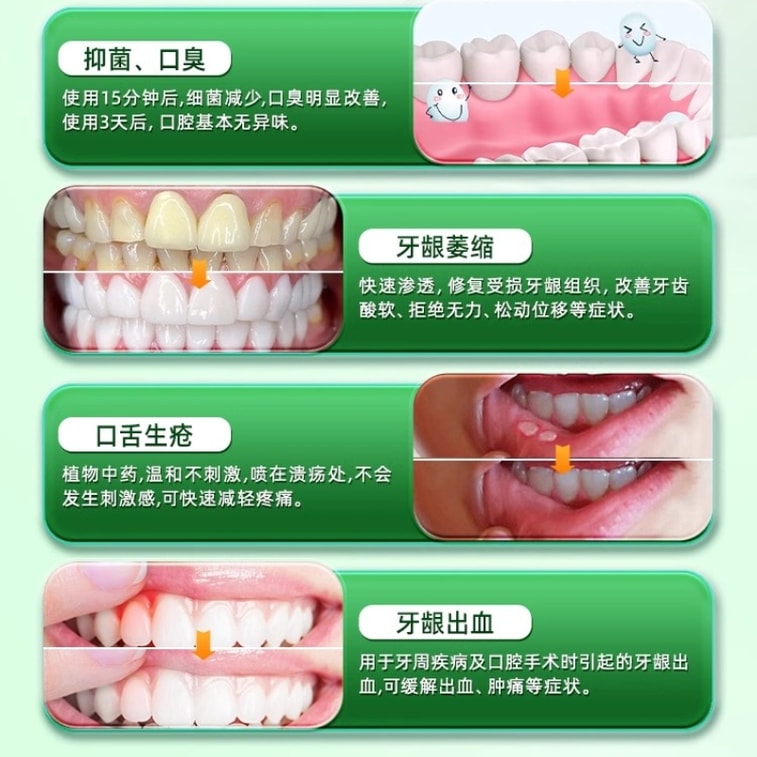 Sipay Dental Firming Effervescent Tablets Treatment Medicine Loose Teeth Specialized Oral Periodontitis 3 Tablets / box 3