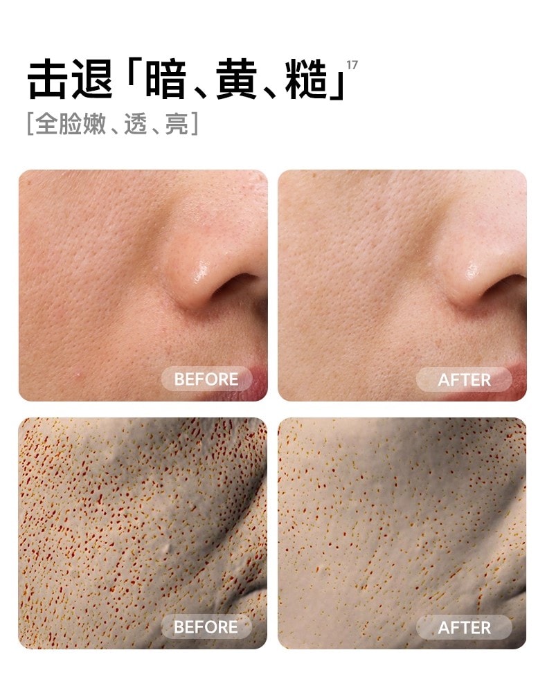 【品牌国内同价】FLOSSOM花至 小紫弹智能射频美容仪器 家用智能美容仪 多功能分区护理 脸部&颈部提拉紧致 速渗透 强透亮FR200 1 件