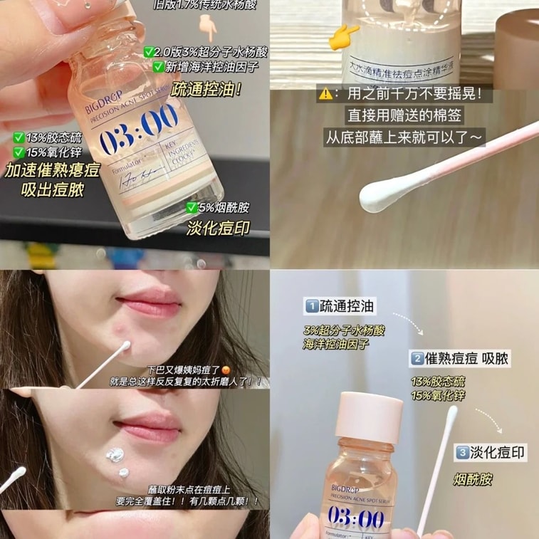 【中國直郵】 大水滴 3點祛痘精華祛痘精華液套裝10ml 9