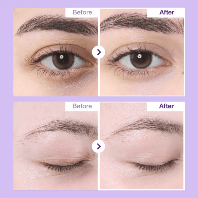 No.9 NAD+ Retinol Volumetox Eye Cream, 0.33 fl oz. 3