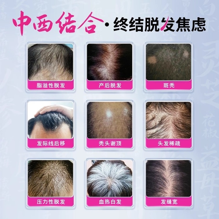 Hair Growth Tablets - Polygonum Multiflorum Blood-Nourishing Hair-Growth Tablets, which Tonifies the Liver and Kidneys. 0.35g per tablet, 108 tablets per box. 3