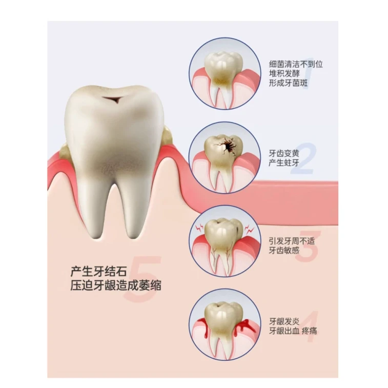 Antibacterial Peptide Whitening Toothpaste - Freshens Breath, Brightens and Cleans Yellow Teeth, Multi-Effect Care, 120g 3
