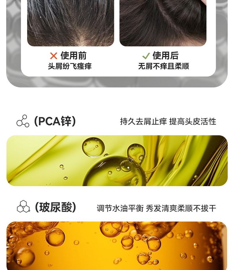 【中國直郵】 和草集 小藍瓶止癢去屑二硫化硒洗髮水 平衡頭皮微生態 淨屑止癢不反复 鳶尾誘惑香型 300ml/瓶