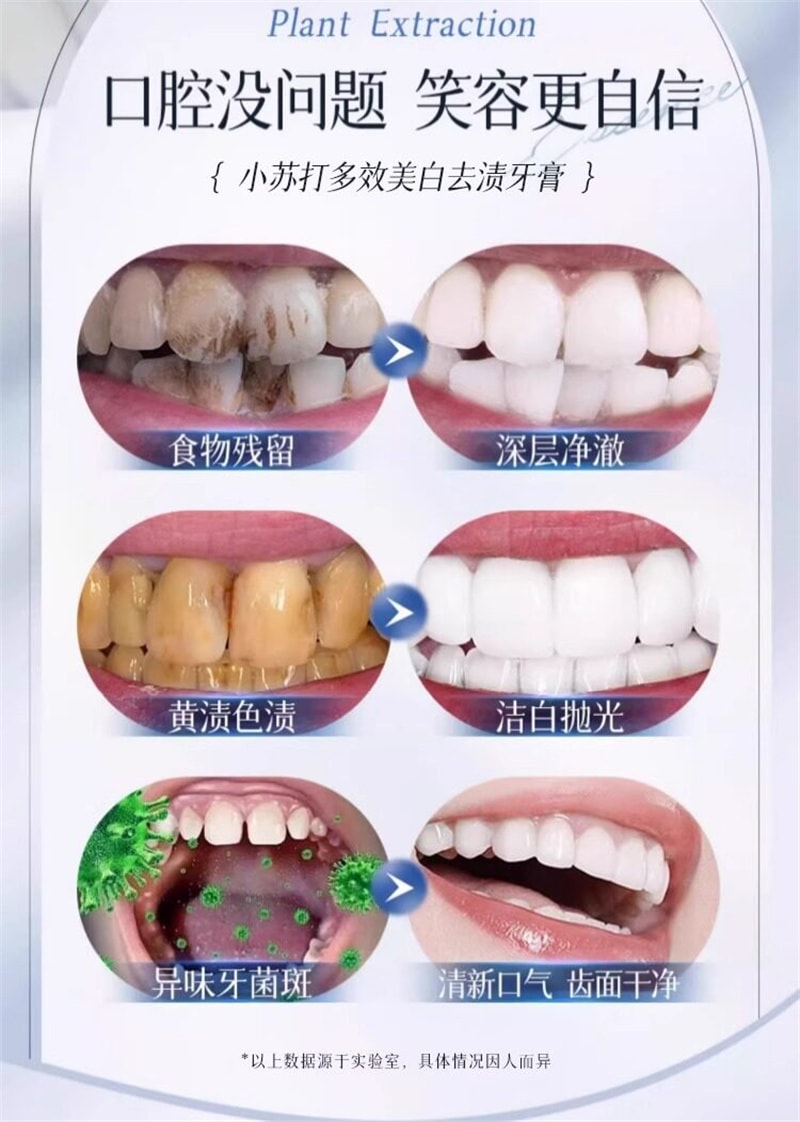 【中国直邮】 云南本草 小苏打多效美白去渍牙膏 去渍去黄去口臭除味速效洗白 250g/瓶