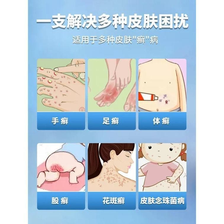 仁和 鹽酸特比萘芬乳膏 腳癬去腳氣真菌感染專用 12g/支 3