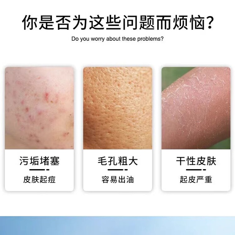 로카 프리미엄 케어 - 통증 없이 부드럽게 각질을 제거하는 타월, 전신 사용 가능, 중국 동북부 목욕탕에서 사용하는 것과 같은 둥근 모양으로 피부에 자극이 적습니다. #블랙 (1개) 6