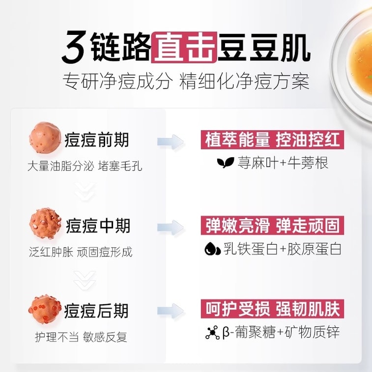 [중국 직배송] 비비스 여드름 캡슐 (남녀 공용), 피지 조절, 여드름 및 블랙헤드 제거, 여드름 흉터 완화, 모공 축소, 60캡슐/박스 3