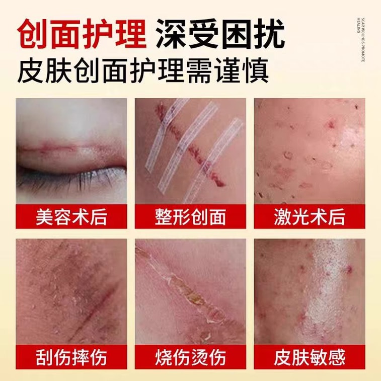 Recombinant Type III Humanized Collagen Dressing 20g Skin care recovery 5