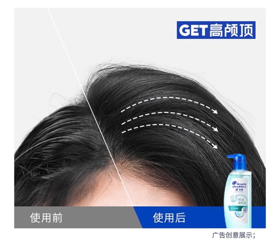 Oil-control, voluminous scalp care shampoo, dandruff removal, softening, oil-control, refreshing and Itch-relieving 360g