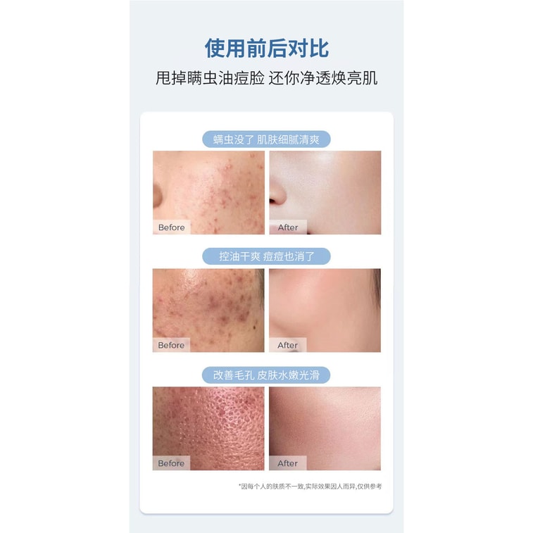 【中国直邮】 仁和 氨基酸控油净颜洁面乳 180g 5