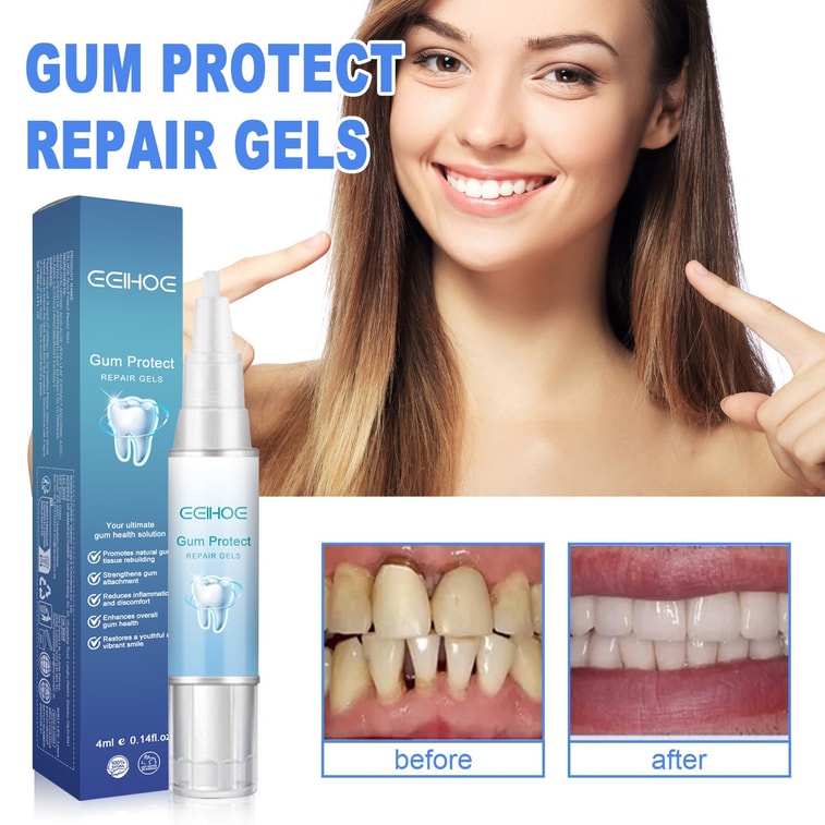 Tooth Repair Gel Repairs Gum Swelling And Pain Deep Cleans Tooth Stains And Plaque Oral Care Gel 4ML 5