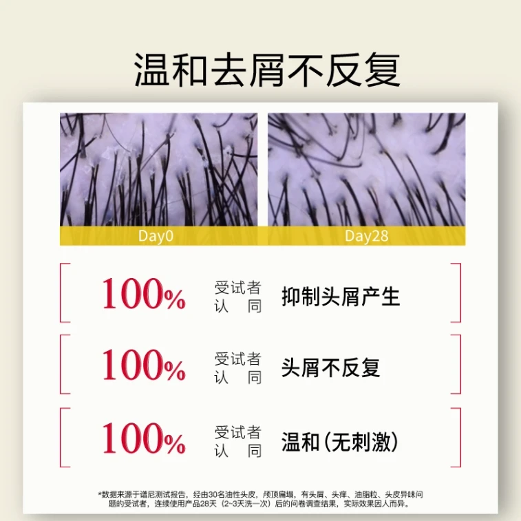 【中国直邮】 John Jeff 姜黄洗发水300g 蓬松头发 控油去屑 一次蓬松2~3天 3