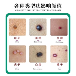 Spot Removal Cream - Scar-Free Pigmentation & Removal Solution for Facial Use 5g/Box