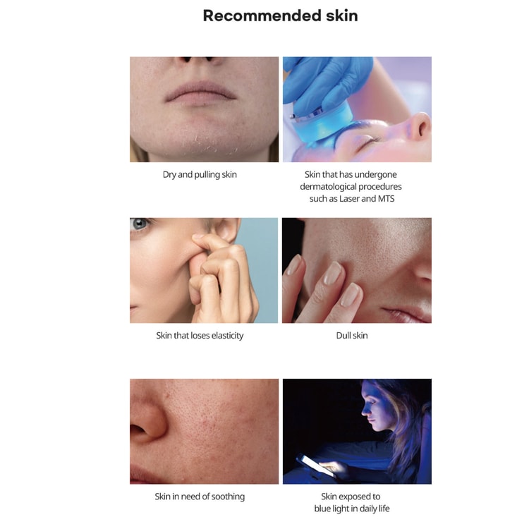 LAFIN COMPLETE RENEW CREAM 35g - Yami.com