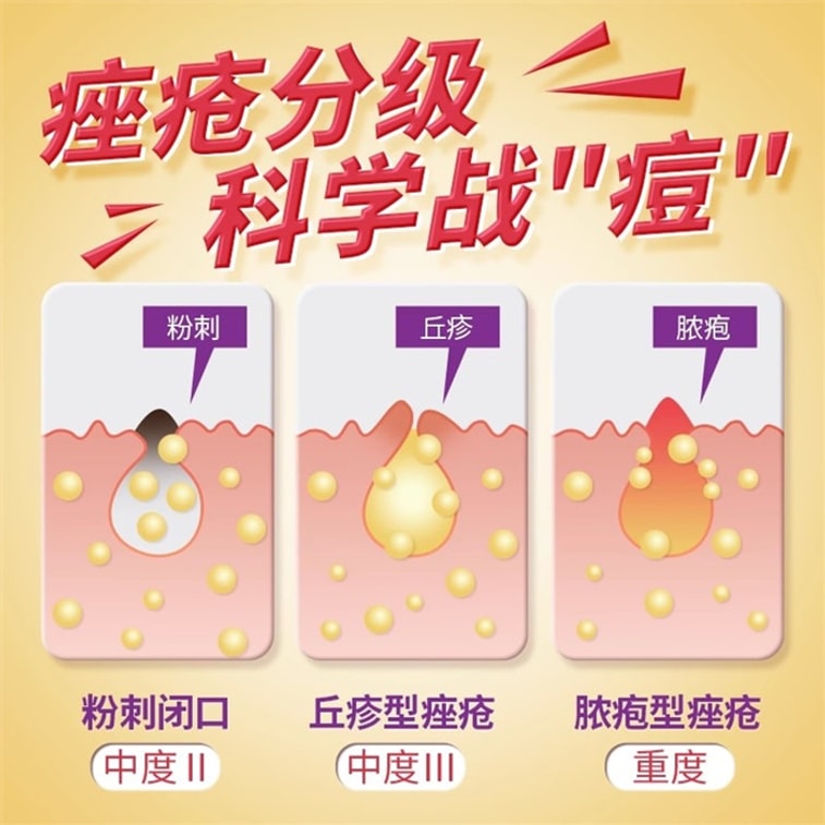 Jinhua Xiaoao Pills for acne acne elimination and detoxification 72g per box for acne and pimples 3