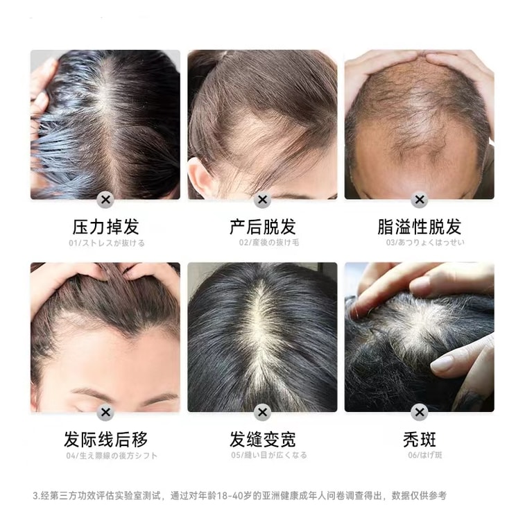 健康な頭皮環境を整える：MEIBOYI 育毛器 電動マッサージコーム 頭皮アプリケーター 赤青光ヘアケアコーム ホワイト（1個） 6