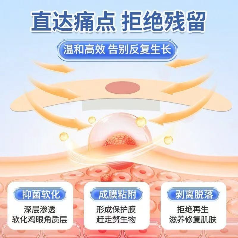 【中國直郵】 甄選好物 葵花雞眼專無痛脫落手足腳底肉刺雞眼腳刺頑固雞眼老繭雞眼貼 1盒/10貼