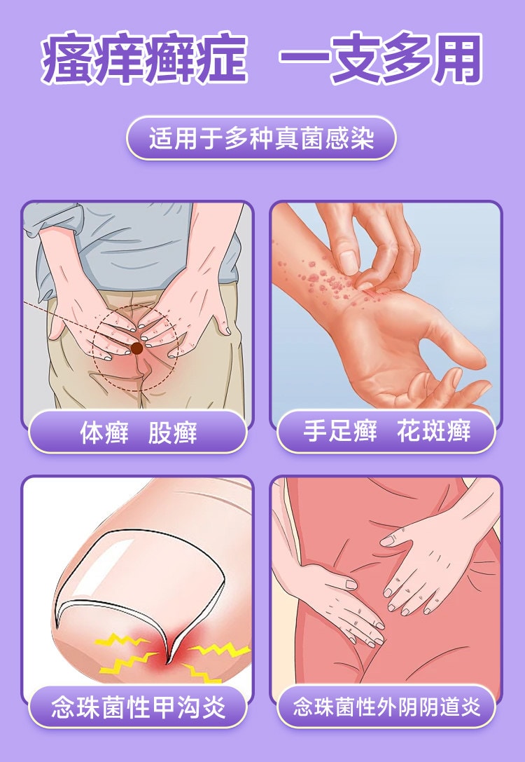 【中国直邮】 妇炎洁 克霉唑乳膏 15g 【抗菌止痒·对抗真菌·多癣症通用】 1%*15g一支 体癣股癣手足癣花斑癣头癣 念珠菌性甲沟炎外阴阴道炎 【真菌感染人群·瘙痒癣症患者·妇科炎症】局部外用 抗生素类OTC抗真菌药膏