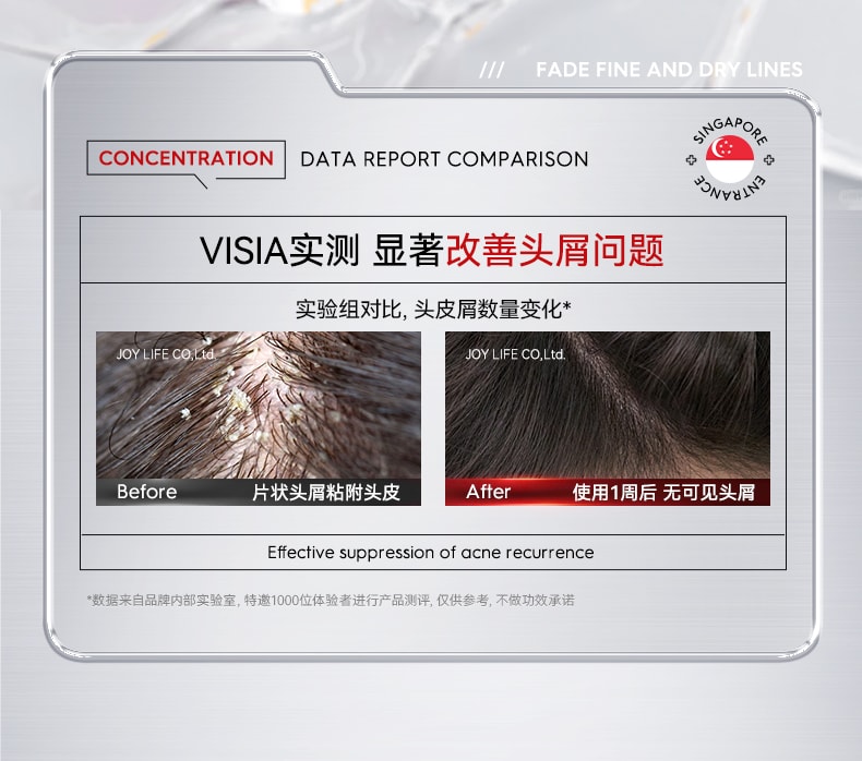 【中国直邮】 新加坡 Kuvive 毛囊净澈洗发水 二硫化硒洗发水毛囊除炎螨去屑止痒控油蓬松洗头膏露男女正品 500ml/瓶