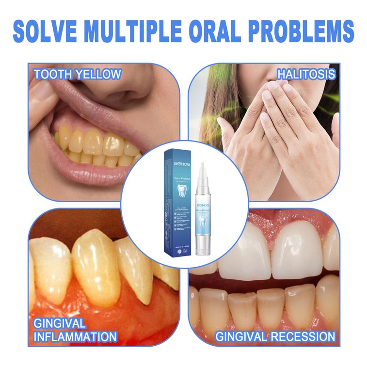 Tooth Repair Gel Repairs Gum Swelling And Pain Deep Cleans Tooth Stains And Plaque Oral Care Gel 4ML 4