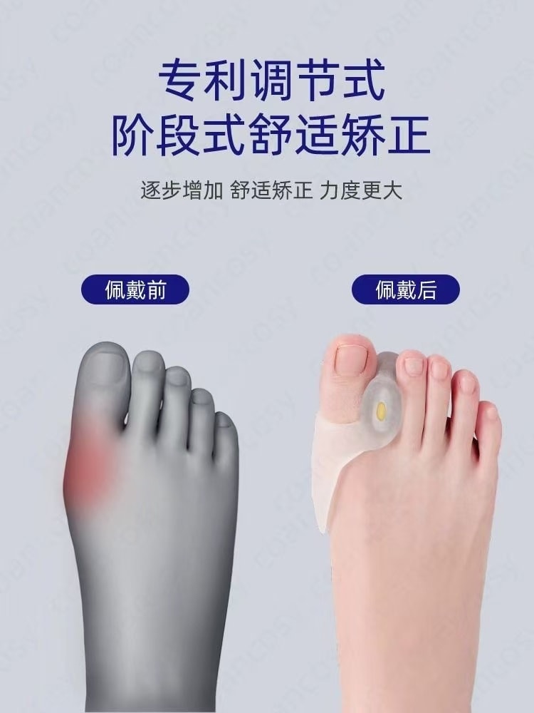 【中国直邮】 茉莉小铺 大母脚趾头外翻分趾隔离器 可以穿鞋 大脚趾防磨保护矫正器 1对装