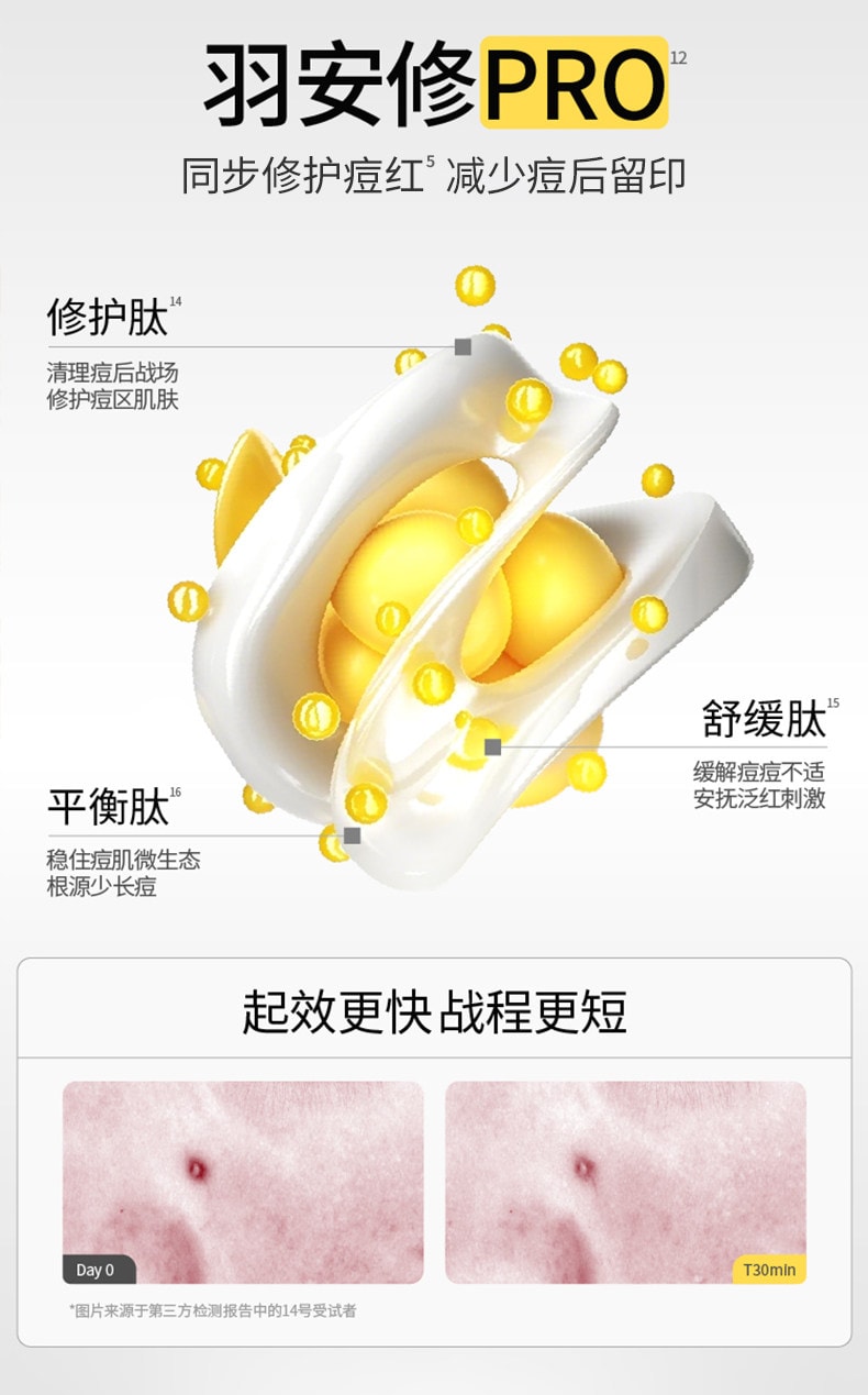 【中国直邮】 羽素 【陈梦同款】祛痘大灯泡 Ⅲ快速去痘 修护舒缓 痘肌精华液 【精准祛痘 痘肌天菜精华】15ml*1瓶