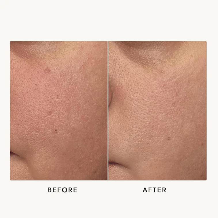 SK2 Pitera Facial Treatment Essence, 11.16 fl oz. - Strong Barrier Antioxidant Repair Shrinks Pores Anti-Aging 4