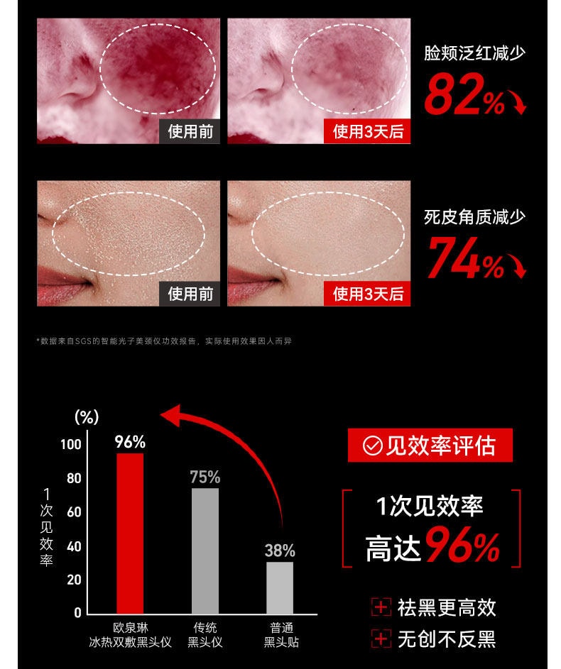 【中國直郵】 歐泉琳 吸黑頭神器家用臉部電動小氣泡去黑頭粉刺毛孔清潔儀器強力吸出器 1份