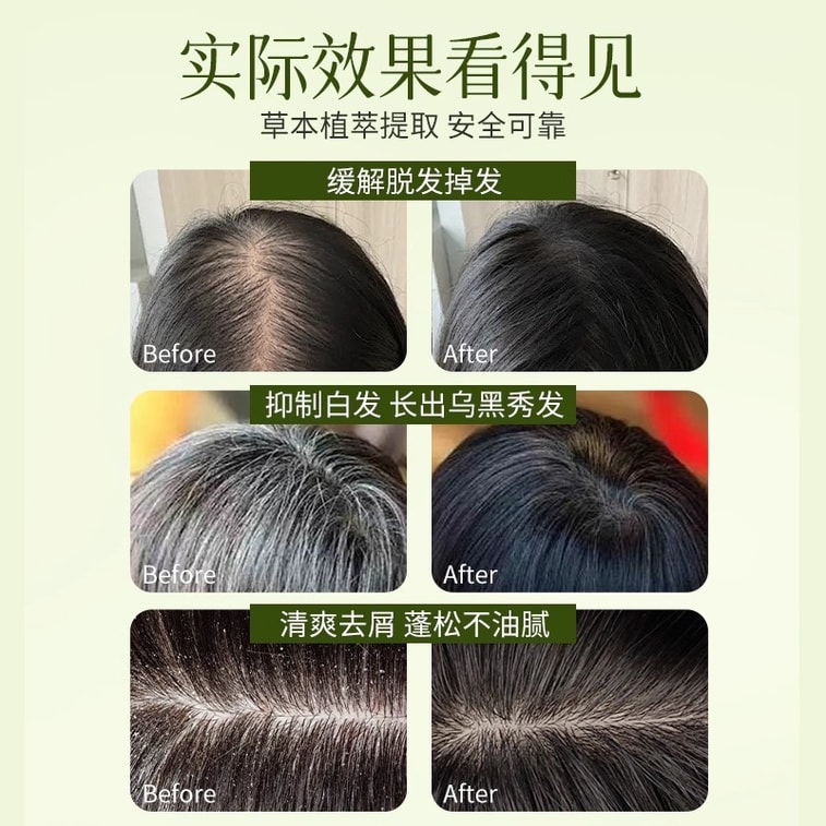 홍콩 파머시 탈모 방지 샴푸 바 100g*2개 [유분 조절 및 비듬 제거] 측백나무 잎, 하수오, 스밀락스 글라브라 성분이 함유된 모발 강화 및 영양 샴푸. 천연 성분으로 순수 수제 제작. 탈모 예방, 모발 성장 촉진, 모근 강화, 두피 영양 공급. 4